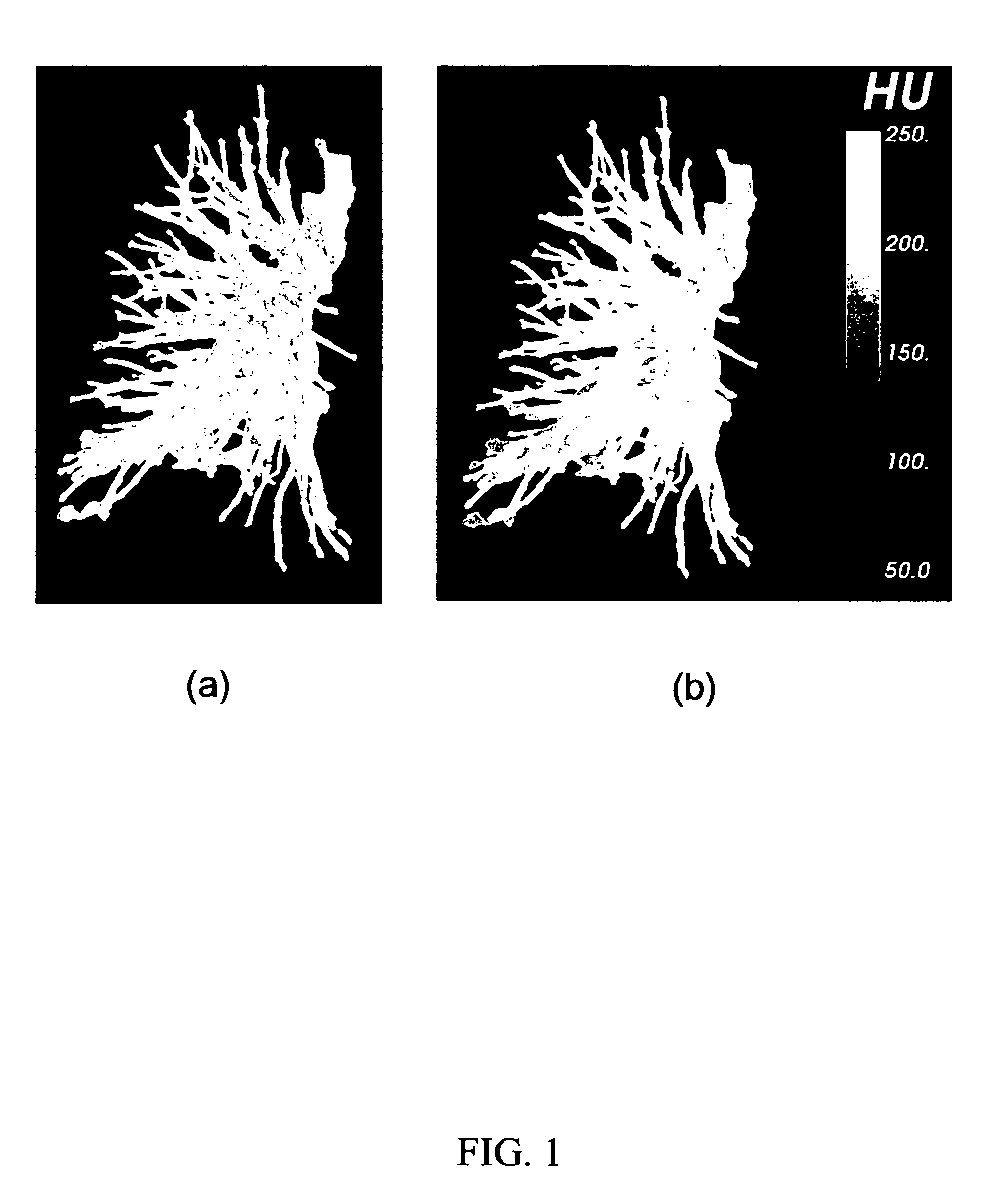 System and method for tree projection for detection of pulmonary embolism