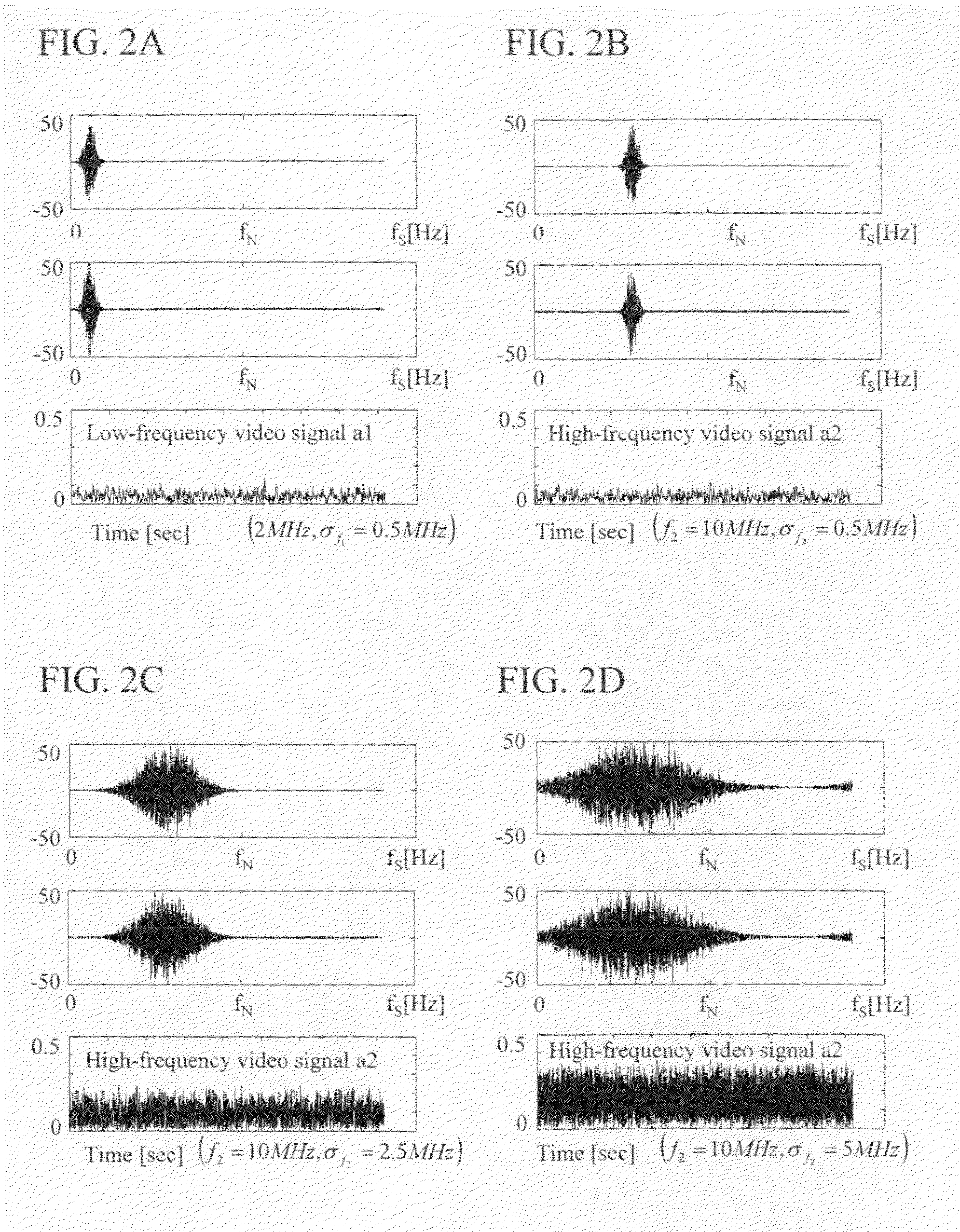 Ultrasonic imaging apparatus