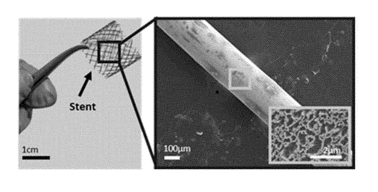 Multifunctional bioimplantable structure and method of preparing the same