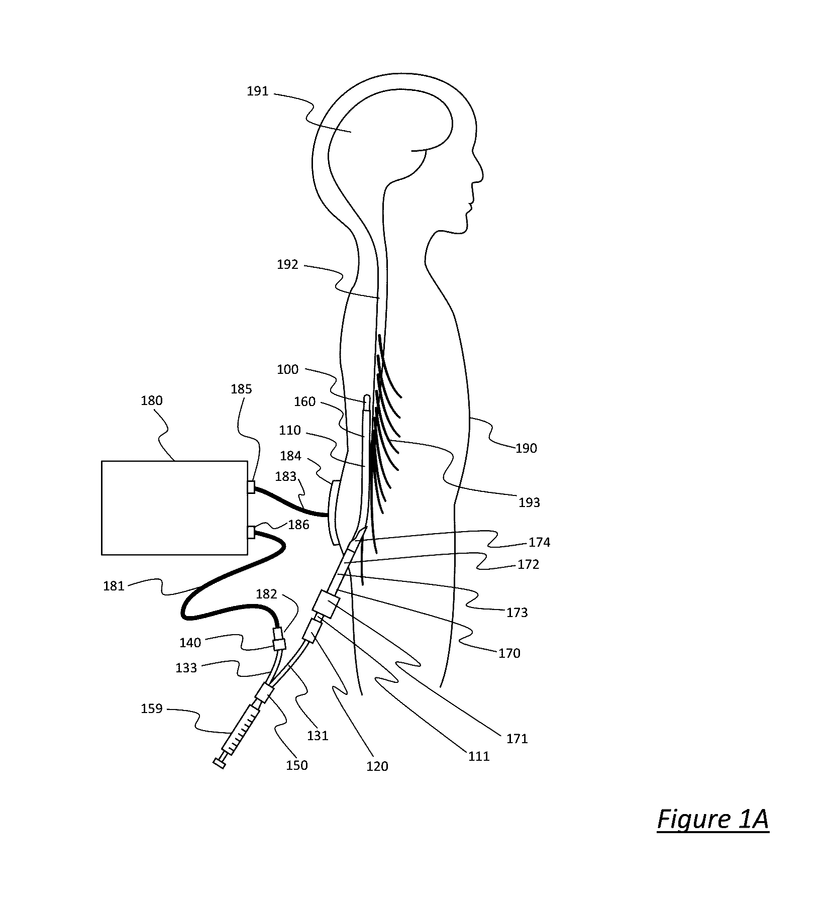 Catheter System