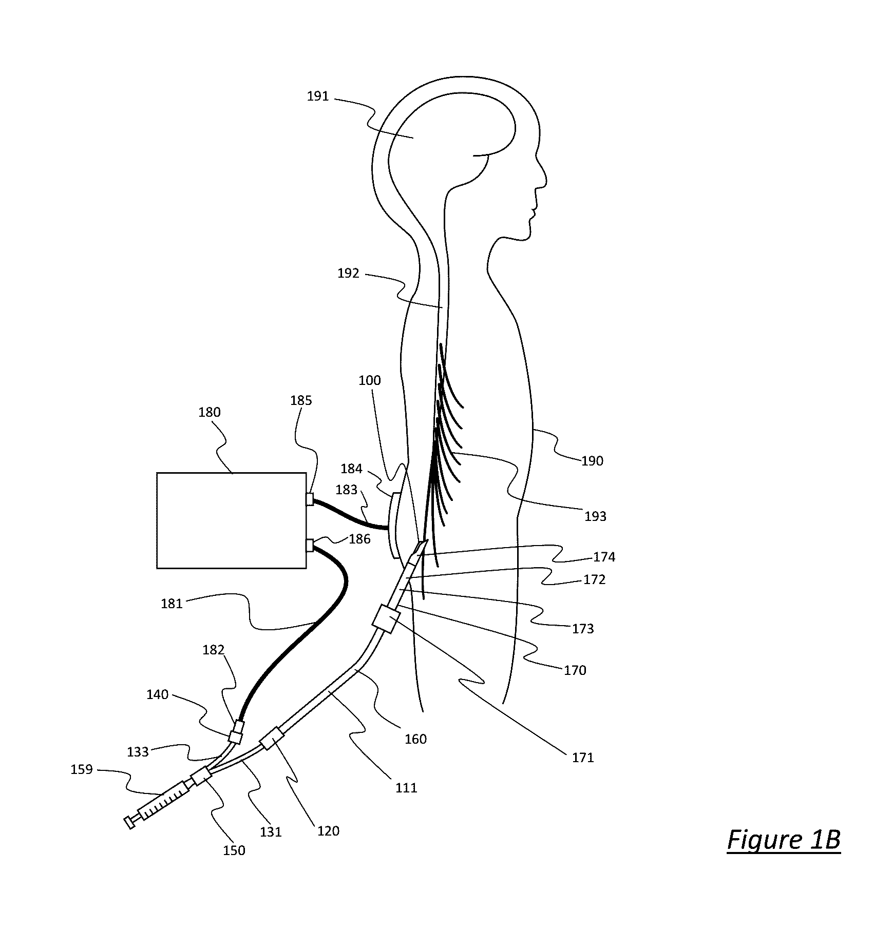 Catheter System