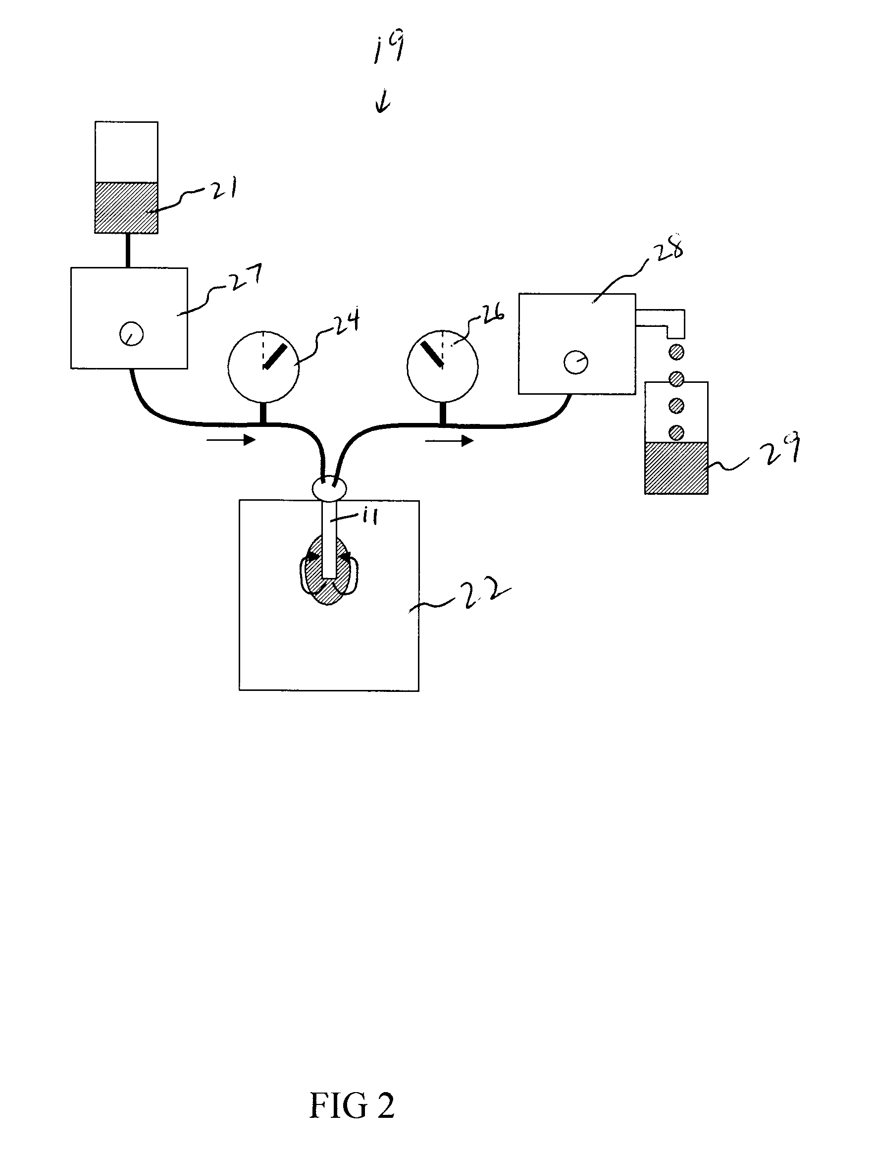 Venting/pressure adjustment to aid in delivery of material into an anatomic region via a cannula