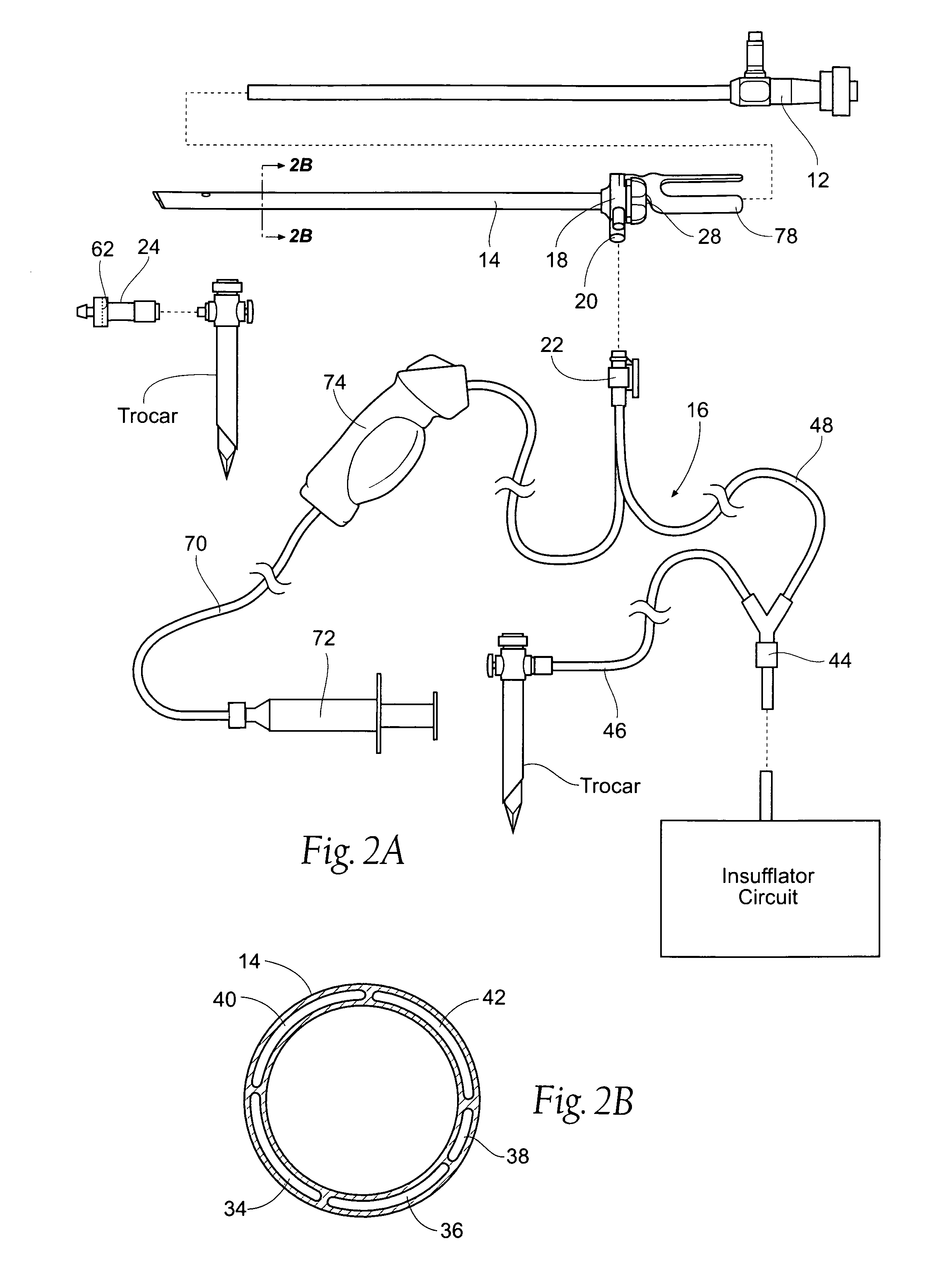 Systems and methods for optimizing and maintaining visualization of a surgical field during the use of surgical scopes