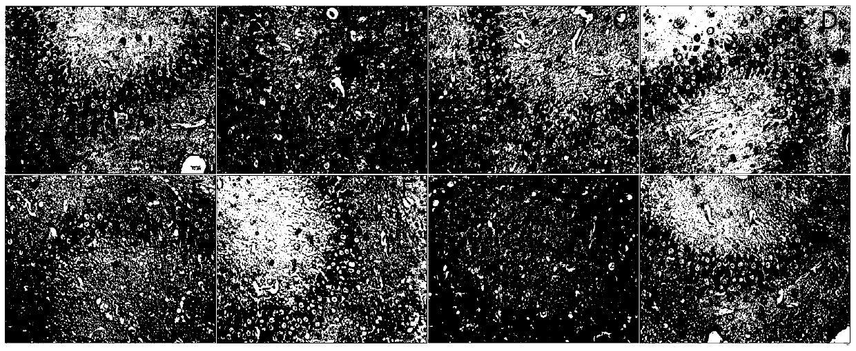 A composition capable of preventing and controlling hyperlipidemia and its resulting cardiovascular and cerebrovascular or neuron damage, and corresponding preparation and use methods