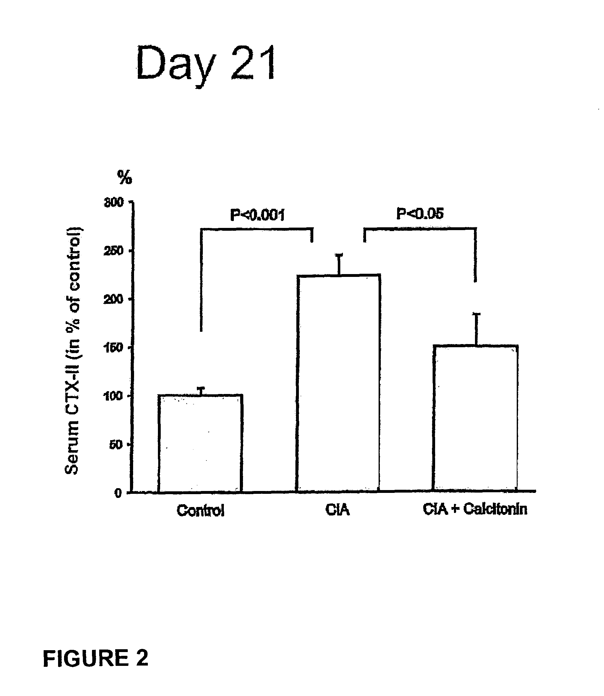 Use of Calcitonin for the Treatment of RA