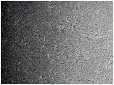 Cell therapy composition for treating osteoarthritis and cartilage defects