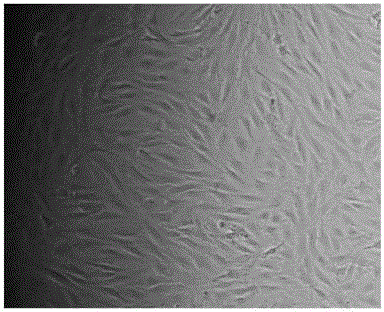 Cell therapy composition for treating osteoarthritis and cartilage defects