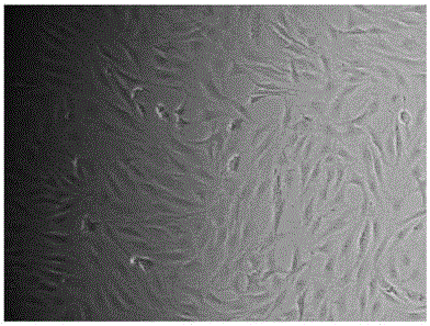 Cell therapy composition for treating osteoarthritis and cartilage defects