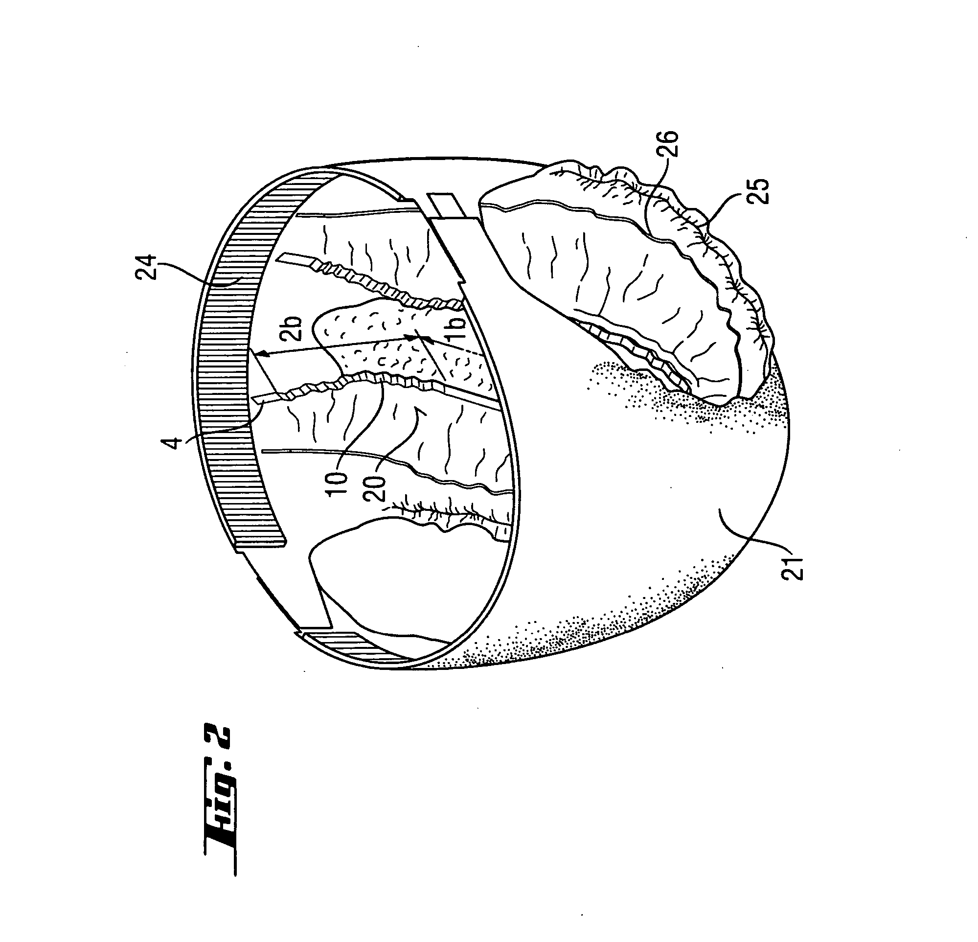 Absorbent articles with comfortable elasticated laminates