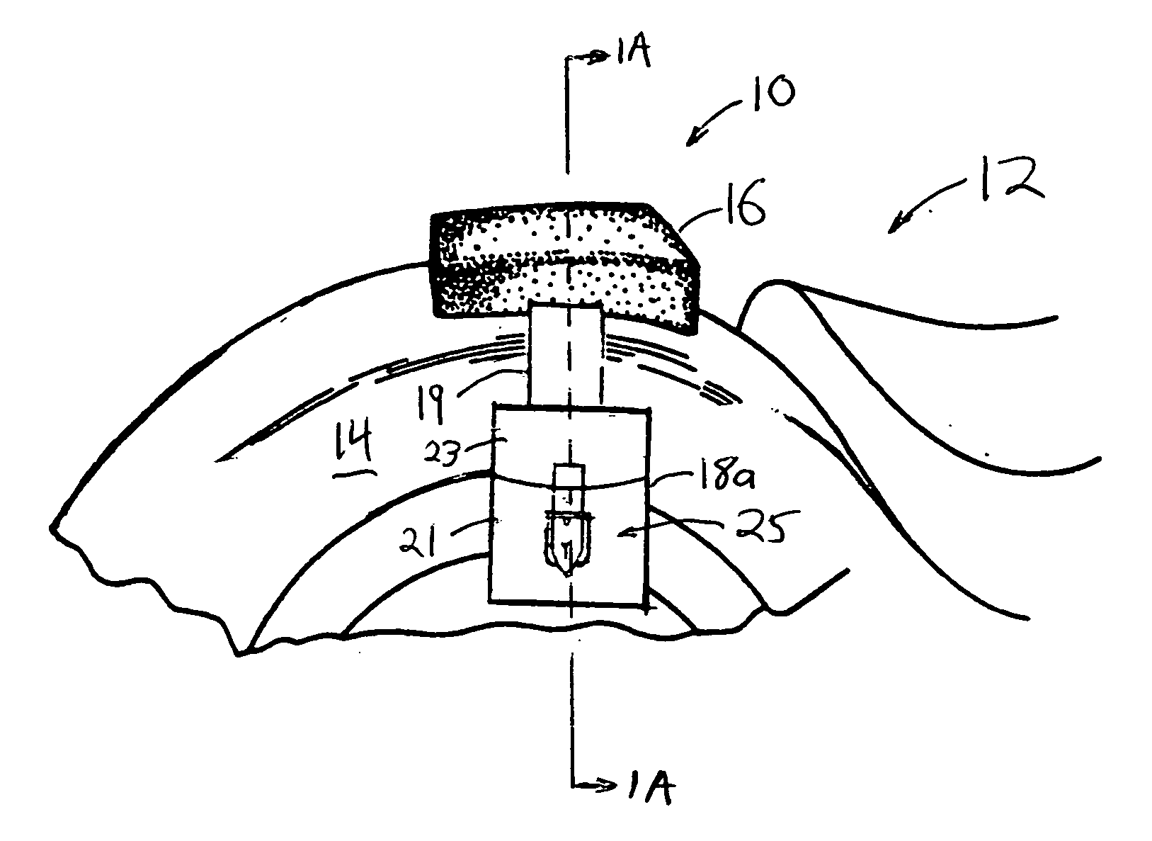 Detachable seat and saddlebag