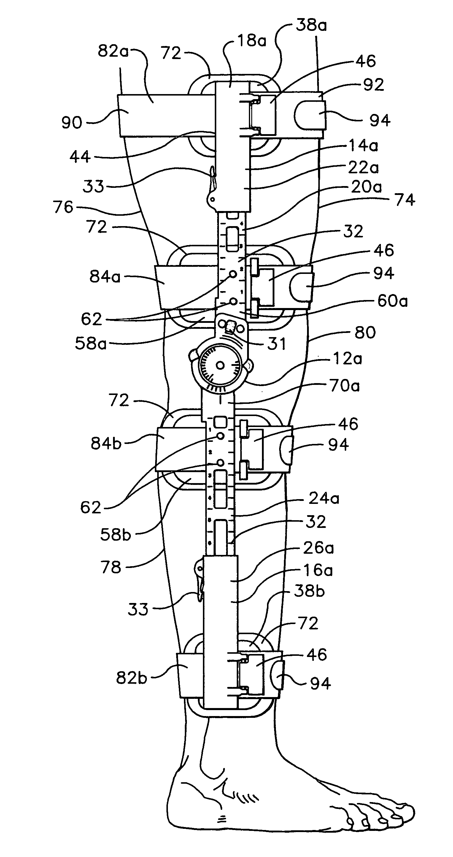 Method for fitting an orthopedic brace to the body