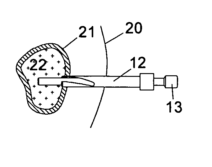 Sleeve, drill and puncture instrument