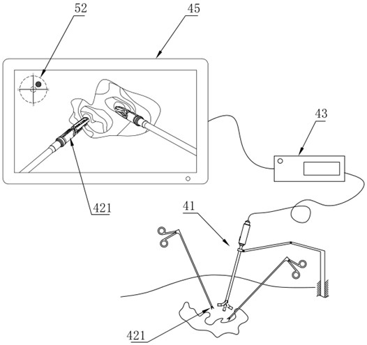 Endoscope lens tracking method and endoscope system