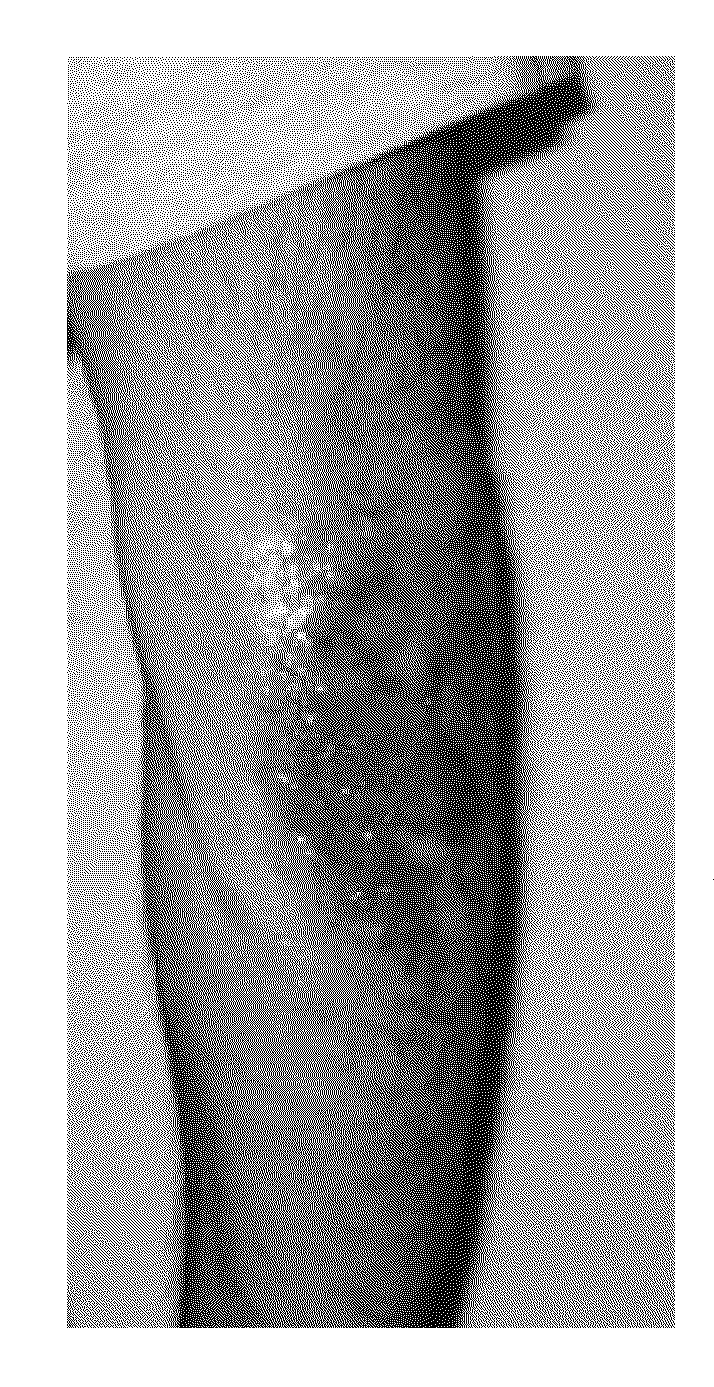 Compositions and methods for treatment of dermal scarring and wrinkling