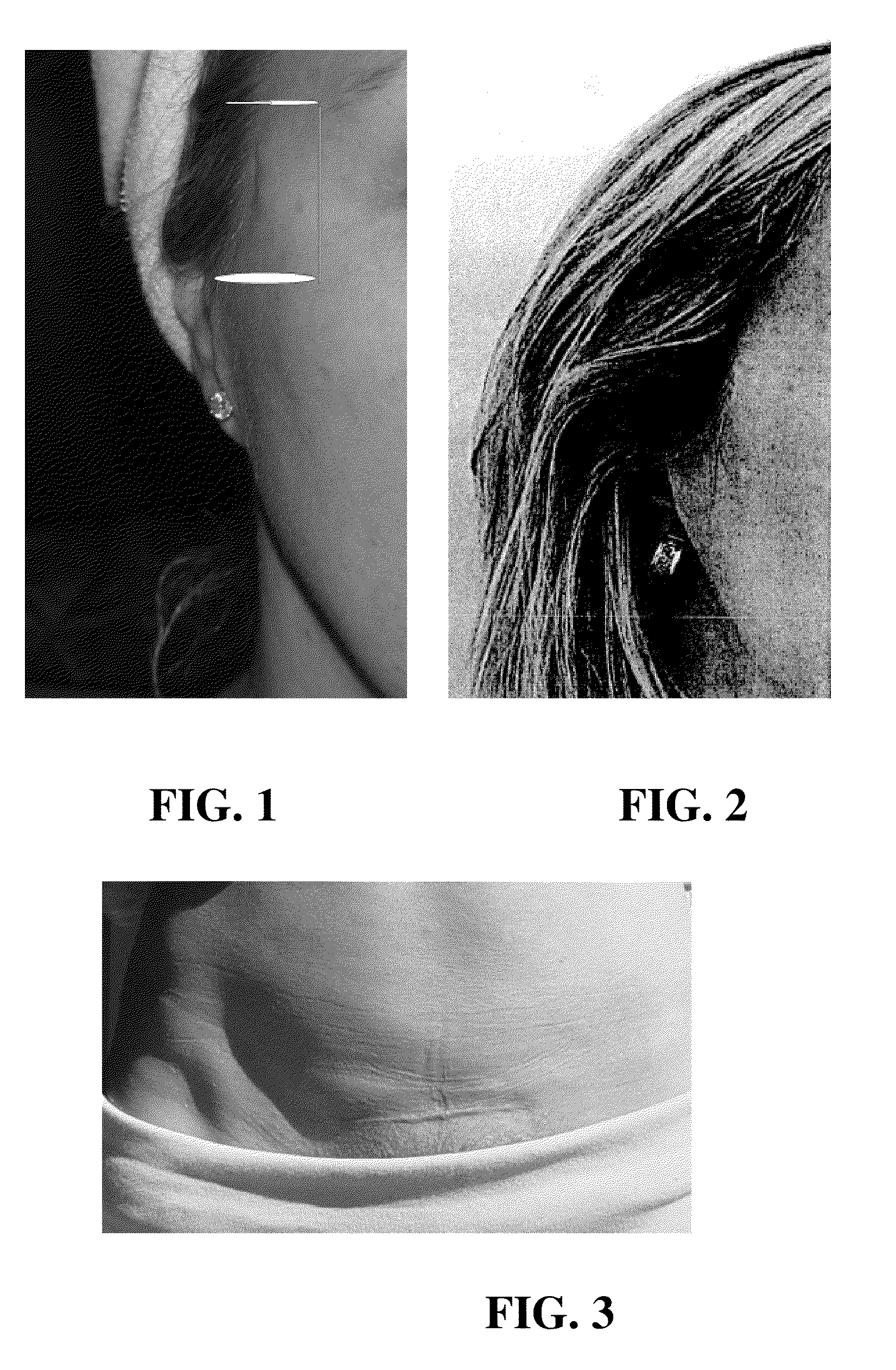 Compositions and methods for treatment of dermal scarring and wrinkling