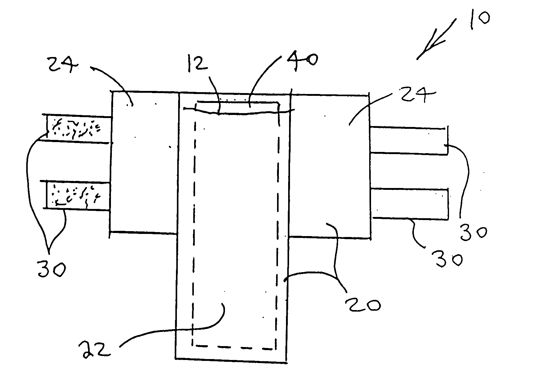 Compact universal splint apparatus for focused immobilization such as of a single digit of the foot or hand, and method