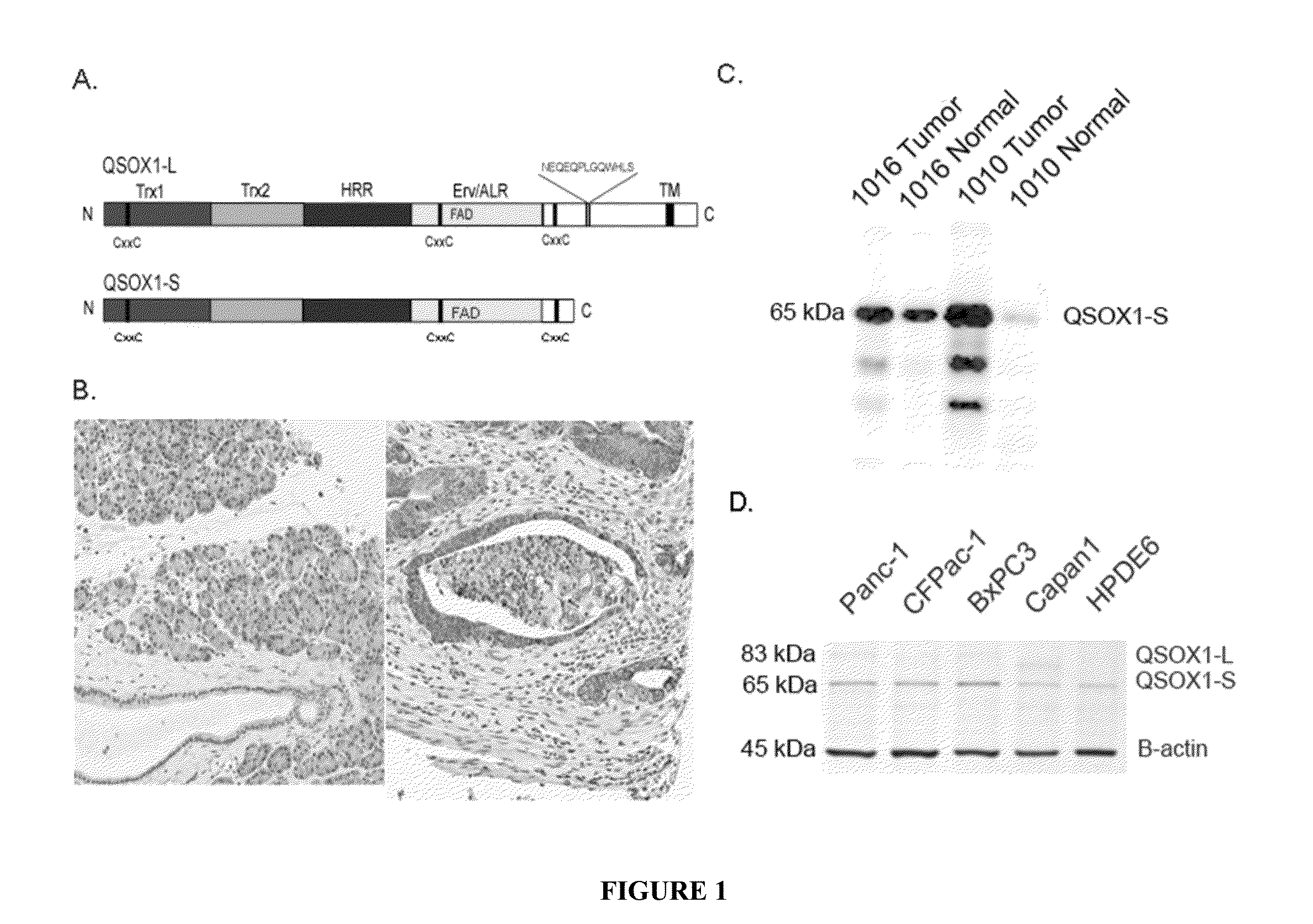 QSOX1 as an Anti-Neoplastic Drug Target