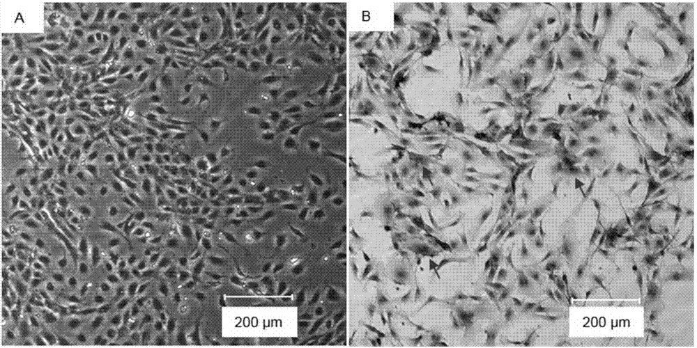 Application of TM9SF1 gene as target point to vascular disease