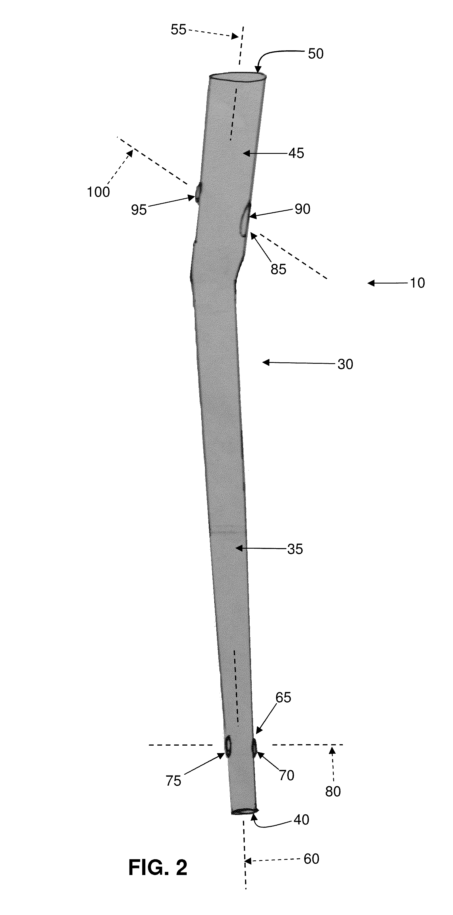 Interlocking intramedullary rod assembly for proximal femoral fractures, including unstable hip fractures