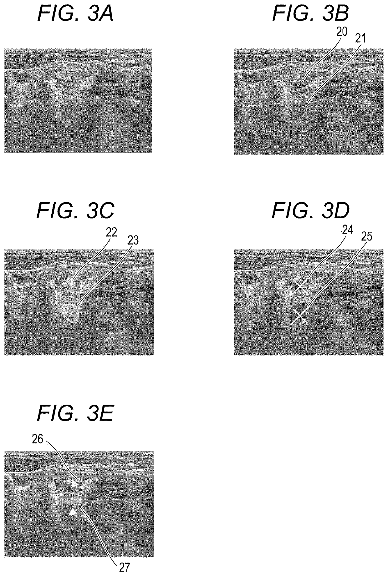 Ultrasonic image diagnostic apparatus, identifier changing method, and identifier changing program