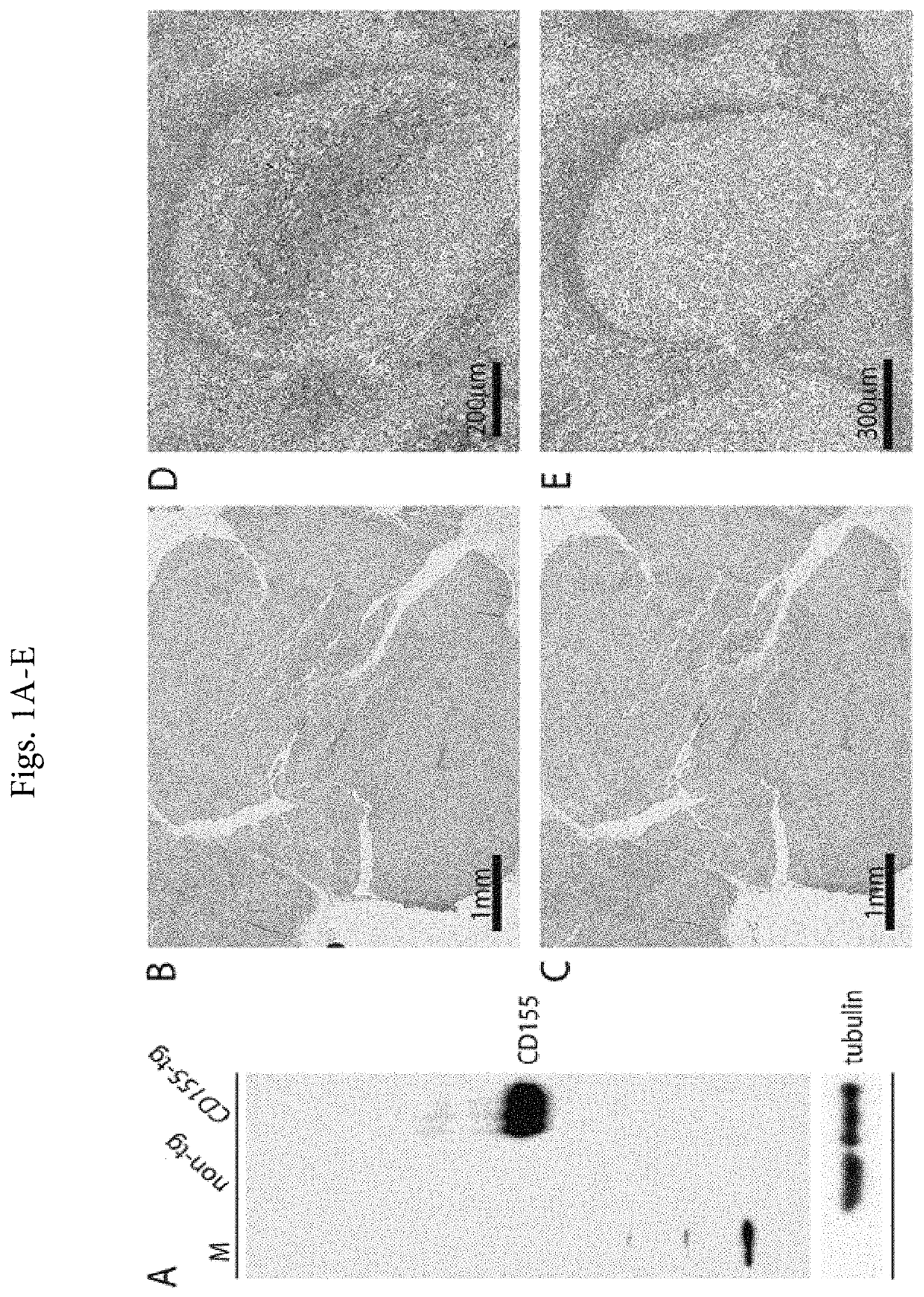 Detection of CD-155, the poliovirus receptor