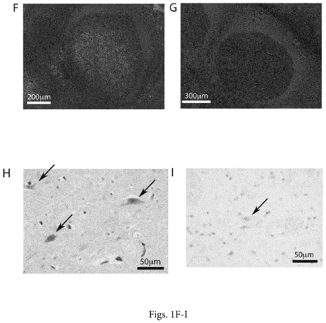 Detection of CD-155, the poliovirus receptor