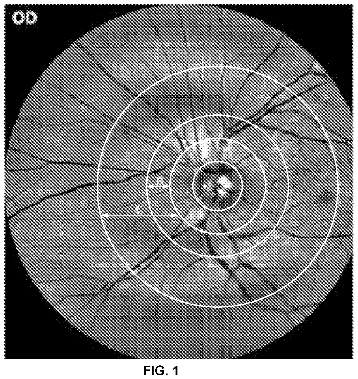 Systems and method for detecting cognitive impairment