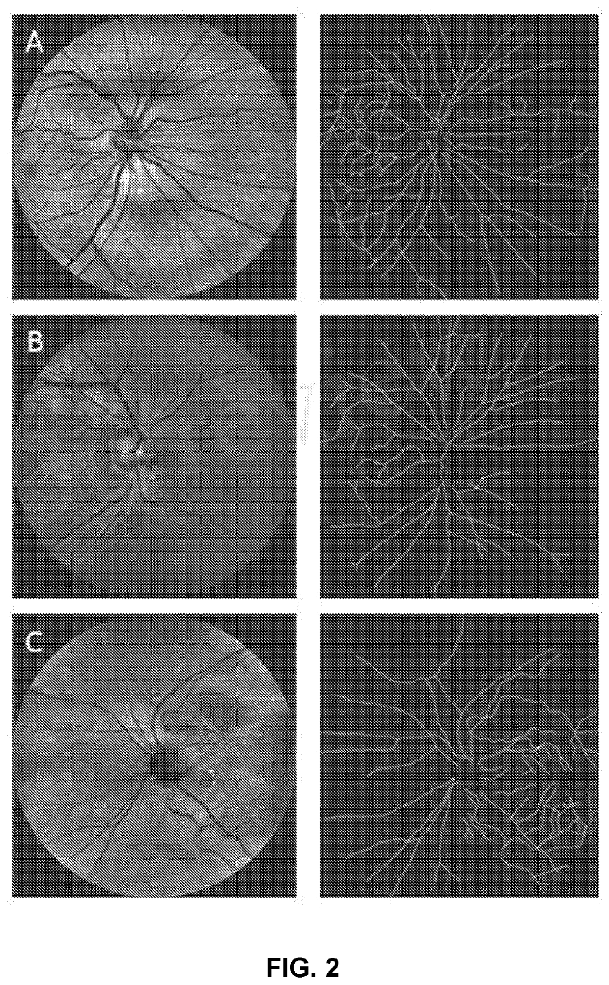 Systems and method for detecting cognitive impairment