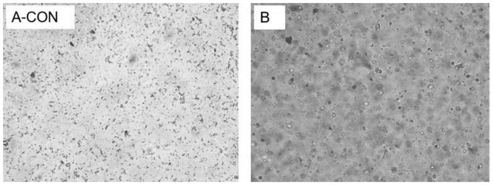 Digestive tract tumor PDX model and construction method of standardized model library