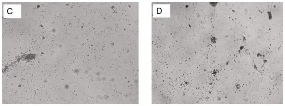 Digestive tract tumor PDX model and construction method of standardized model library