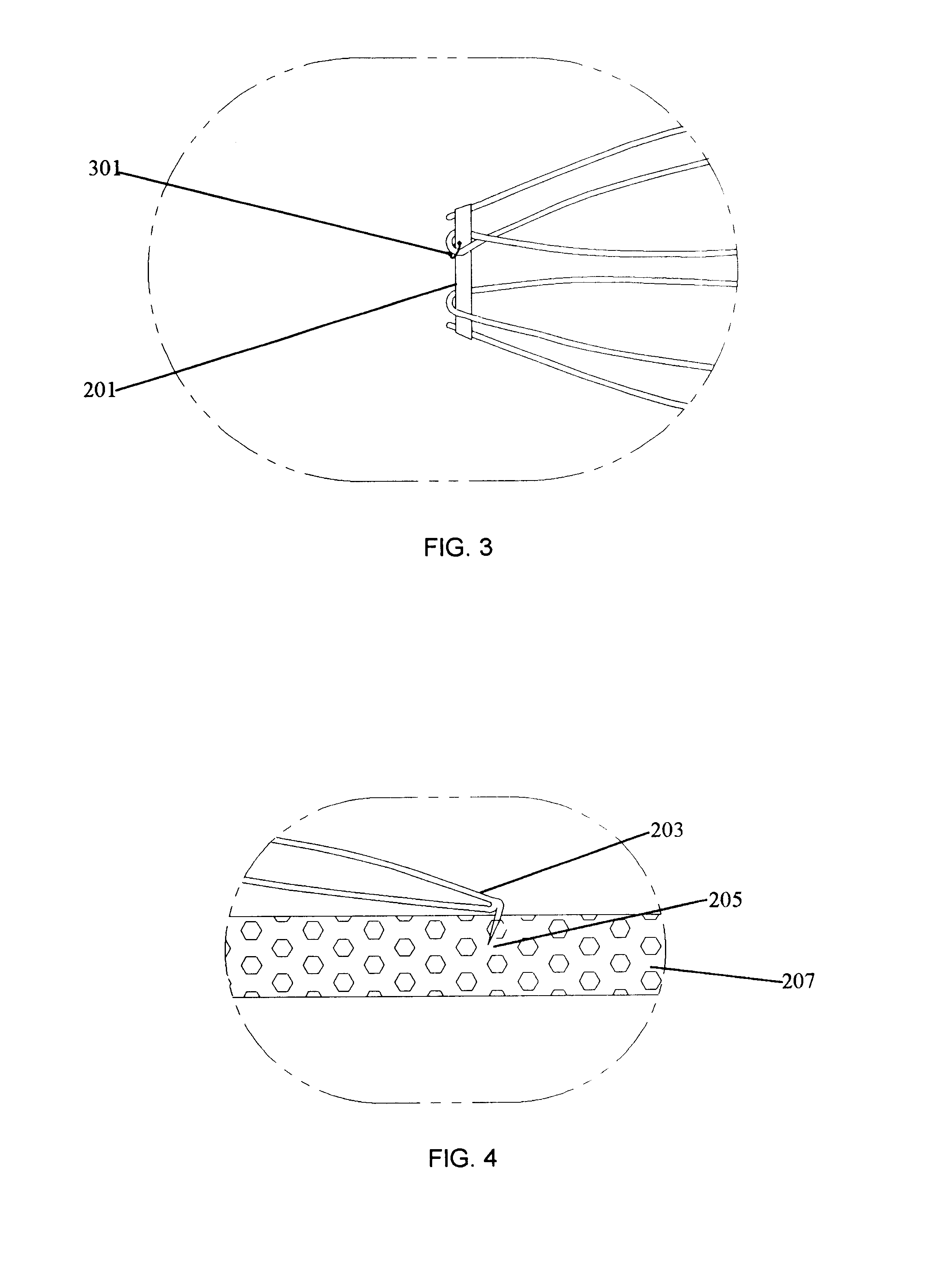 Convertible blood clot filter