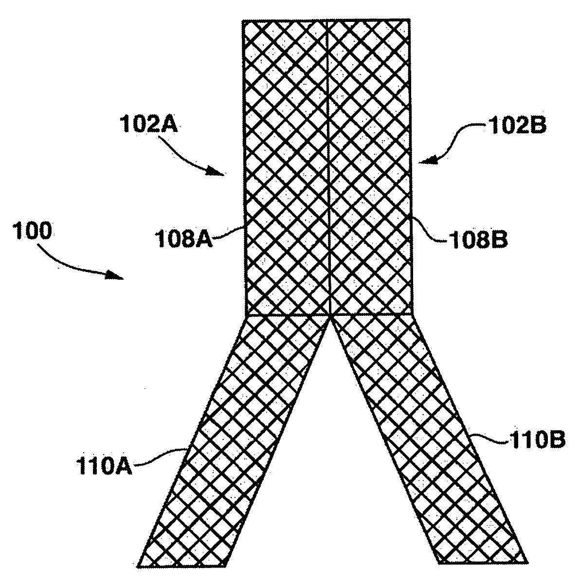 Stent having a C-shaped body section for use in a bifurcation