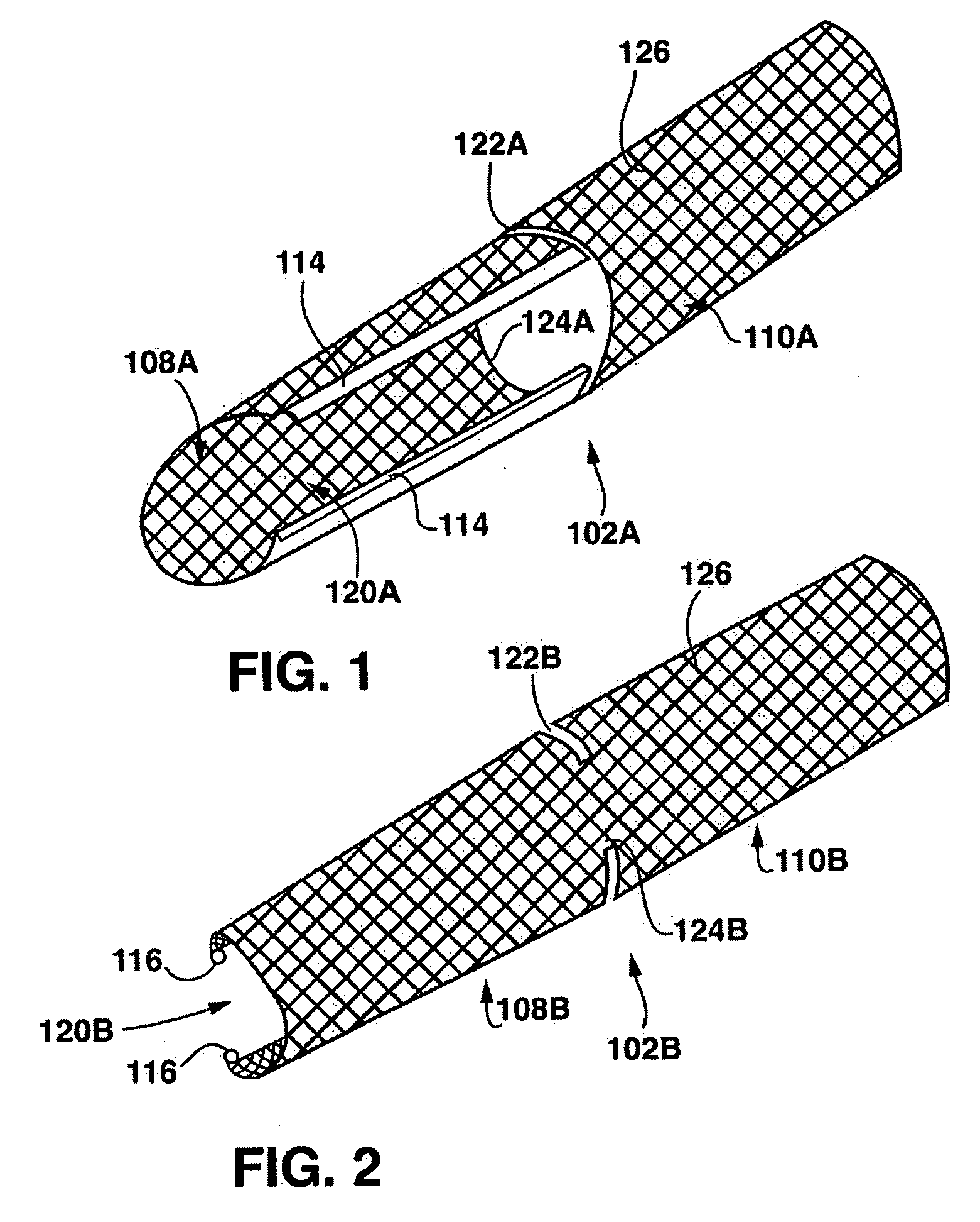 Stent having a C-shaped body section for use in a bifurcation