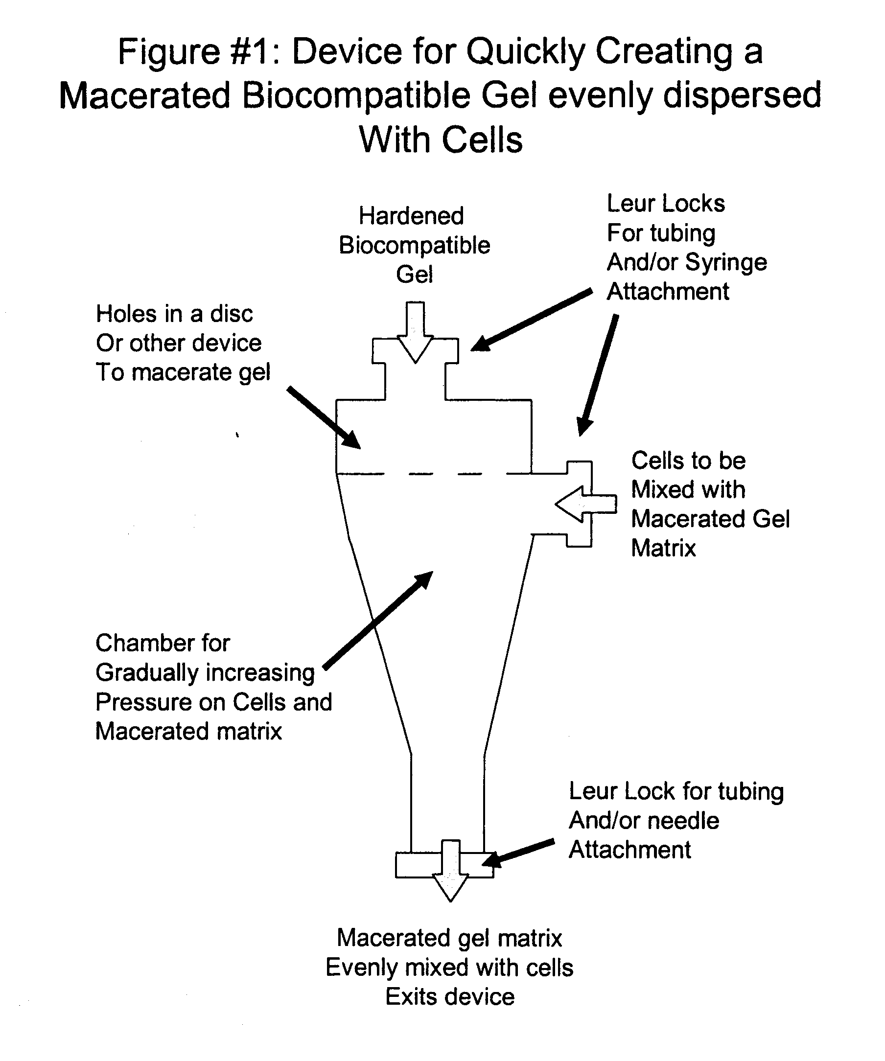 Mesenchymal Stem Cell Isolation And Transplantation Method And System To Be Used In A Clinical Setting