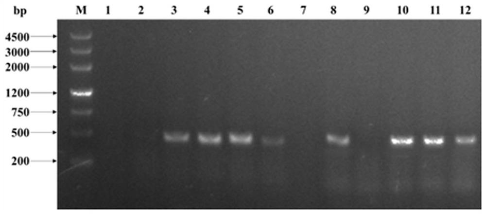 Application of Verticillium dahliae VdPRMT1 gene in improvement of disease resistance of crops or vegetables