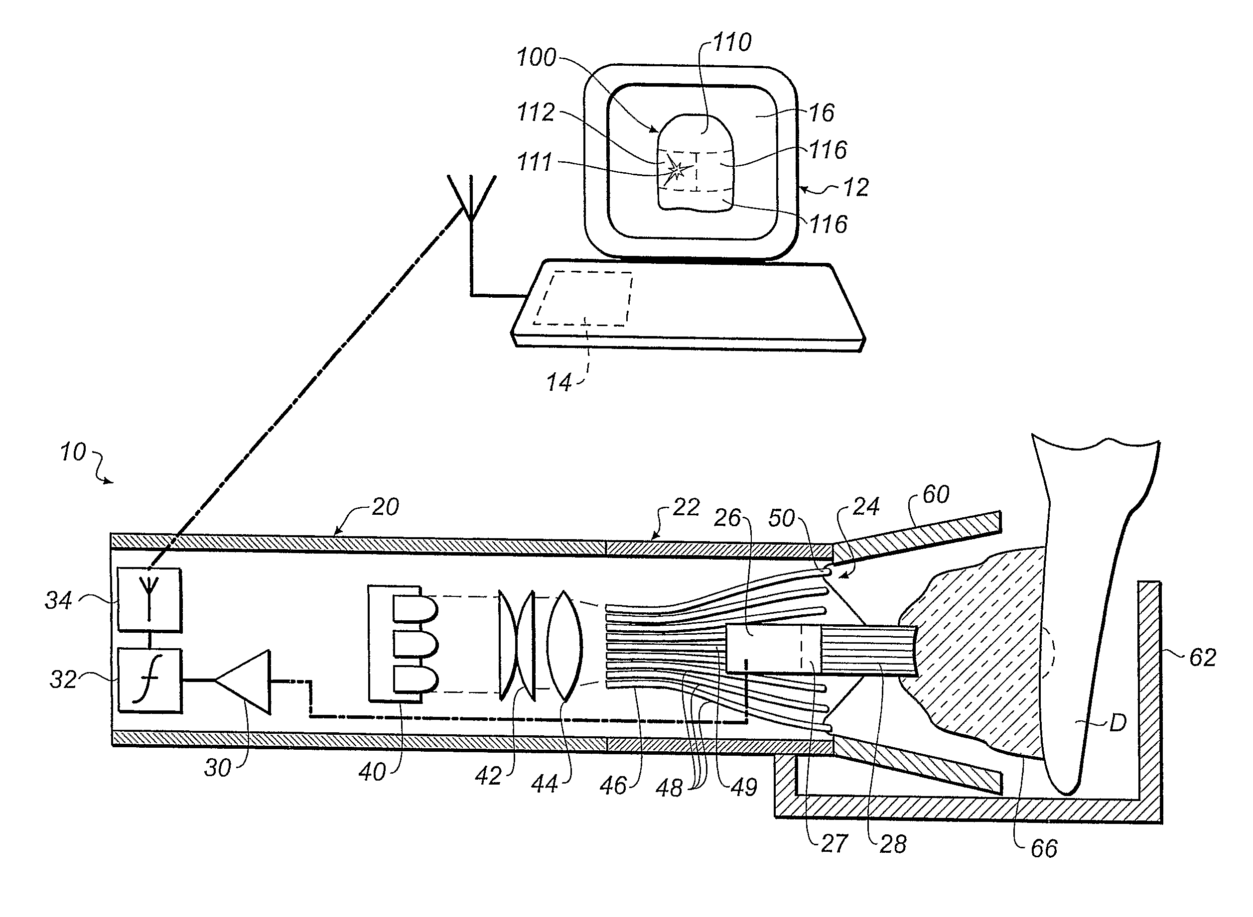 Equipment and method for measuring dental shade