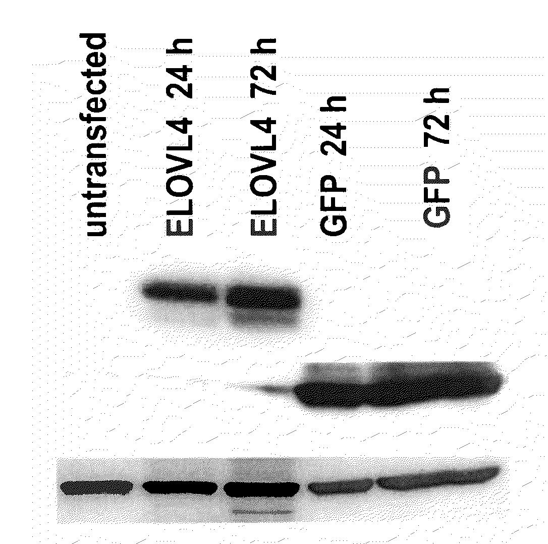 Very long chain polyunsaturated fatty acids, methods of production, and uses