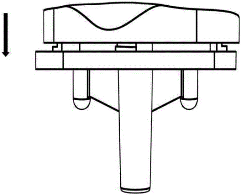 Rotary clamping type shin support and shin pad assembled structure for total knee replacement and implementation method thereof