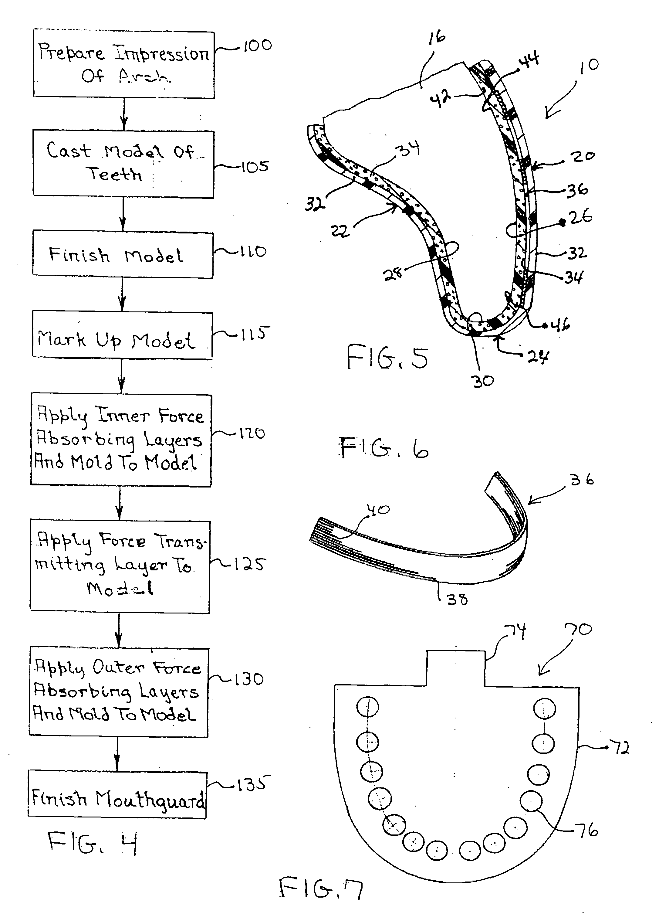 Mouthguard and method of making the mouthguard