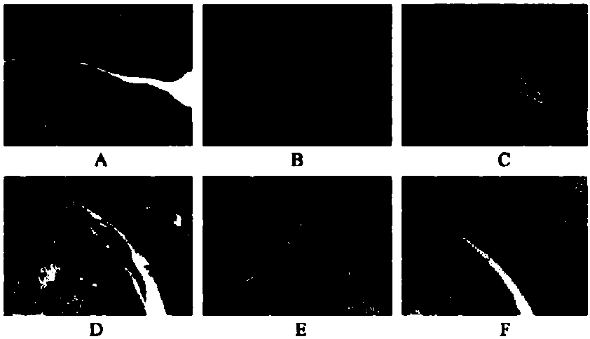 Medical composition for treating rheumatoid arthritis and preparation method and application thereof