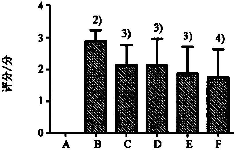 Medical composition for treating rheumatoid arthritis and preparation method and application thereof