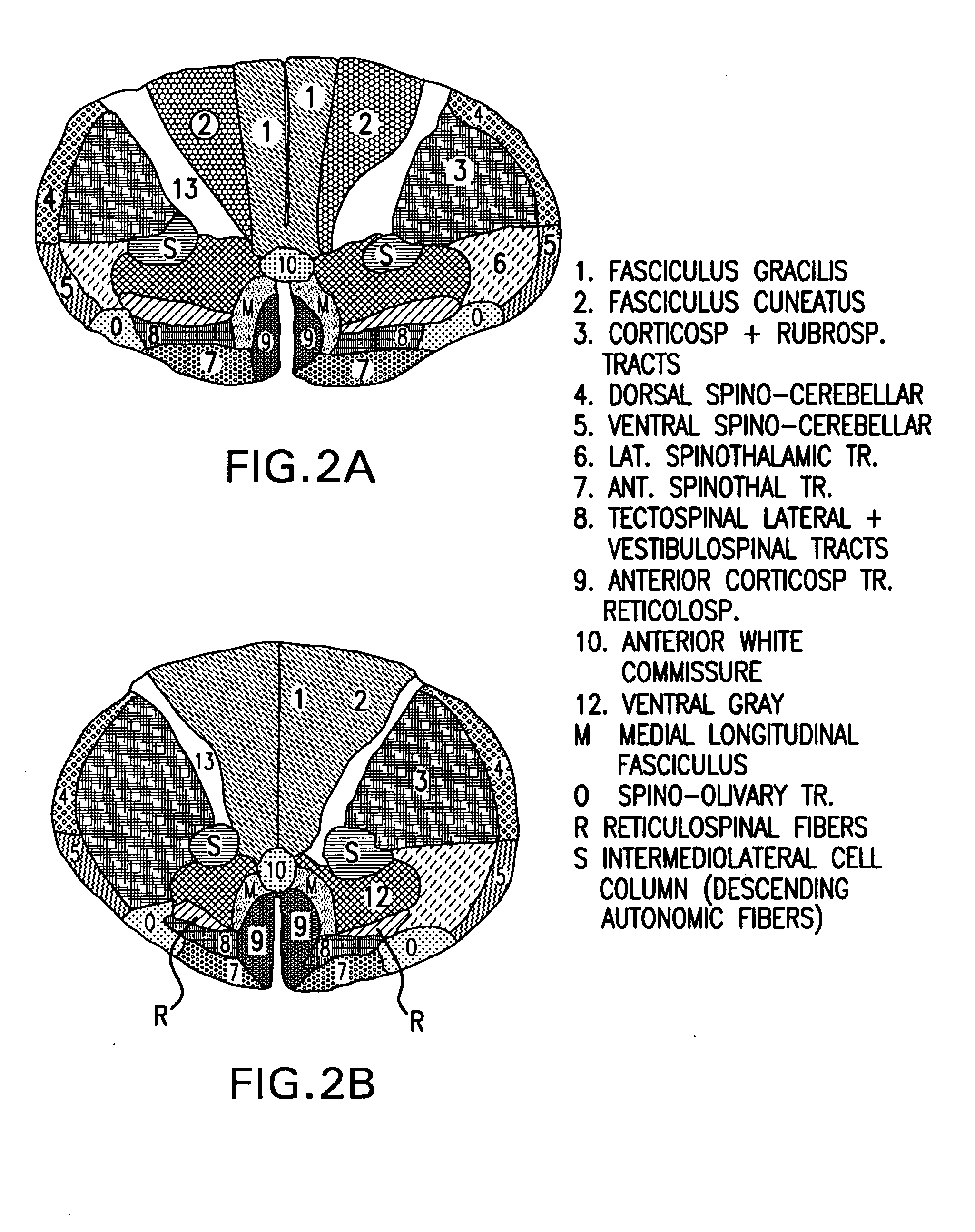 Computer simulation model for determining damage to the human central nervous system