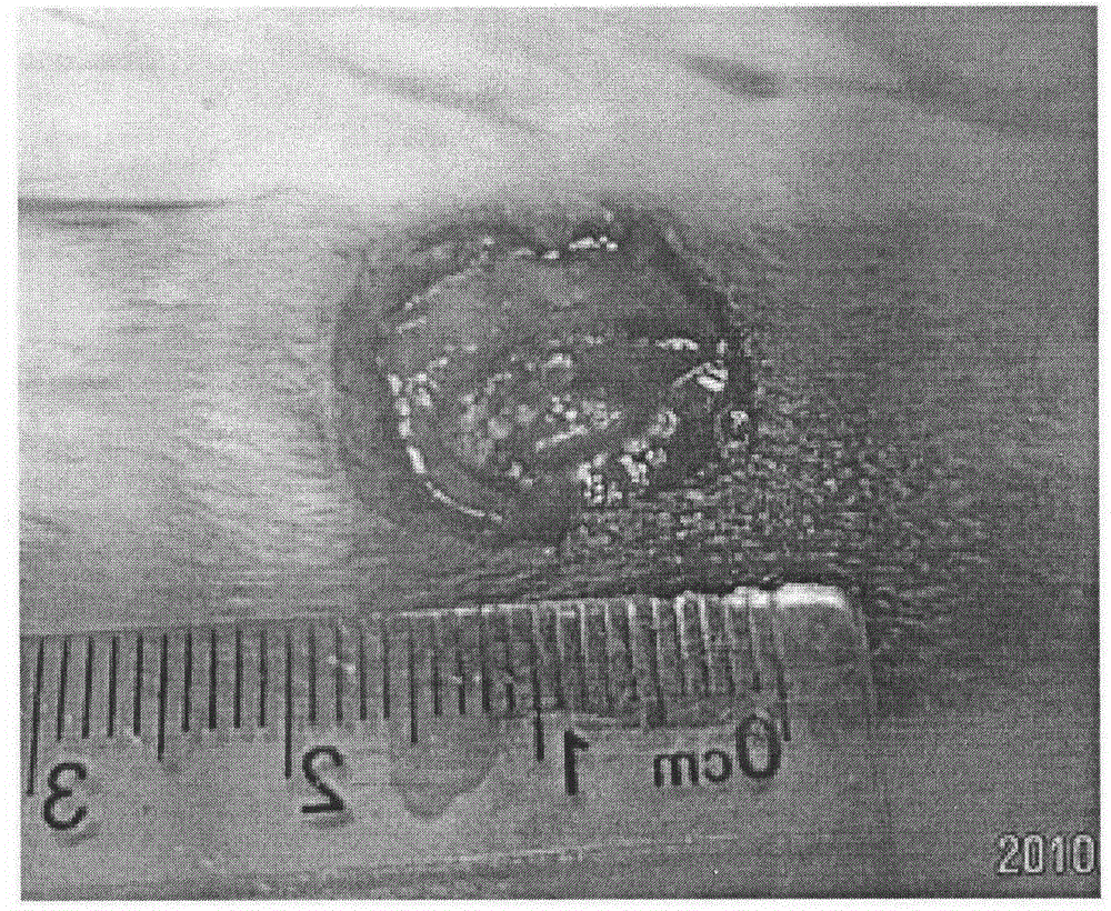 Medical dressing with bioactivity and preparation method of medical dressing