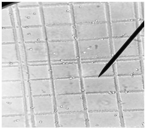 Acid-proof yeast and applications thereof