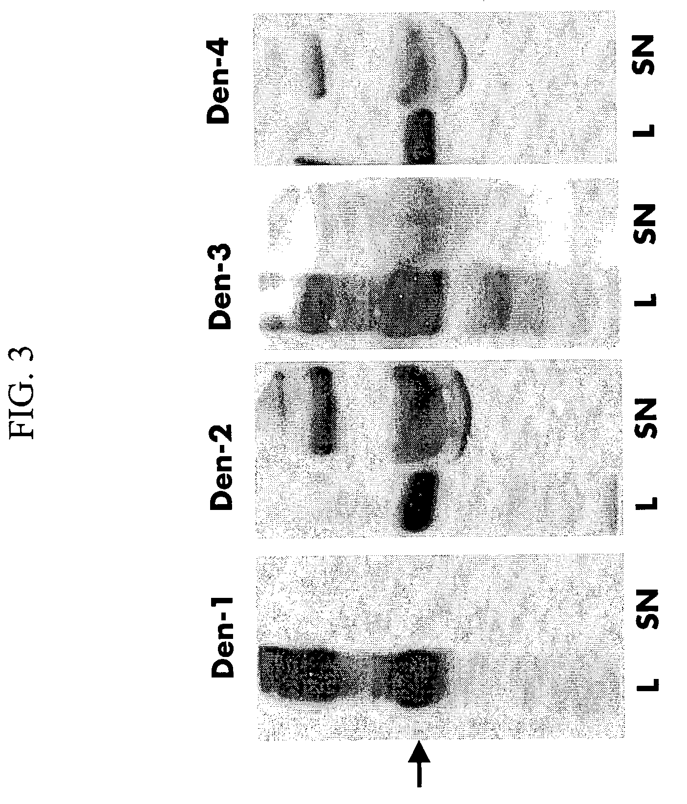 Flavivirus antigens