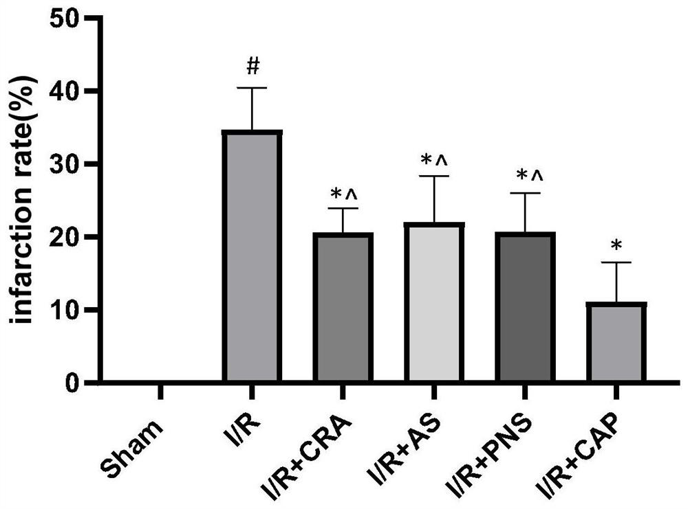 A kind of compound pharmaceutical composition and its application