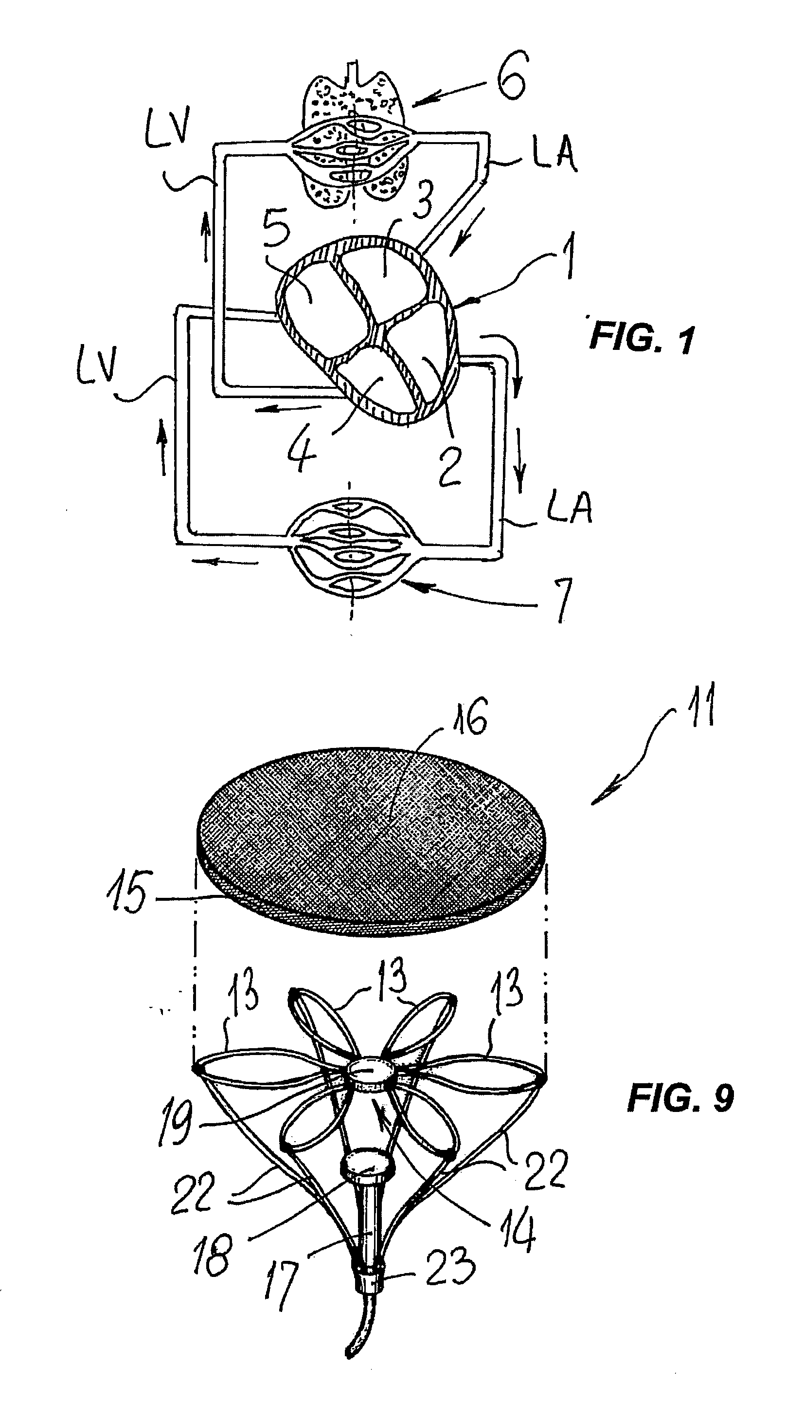 Cardiovascular device