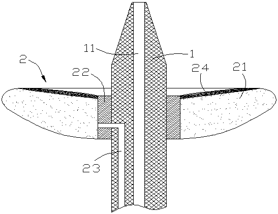 Ovarian cyst stripping leakage-proof device