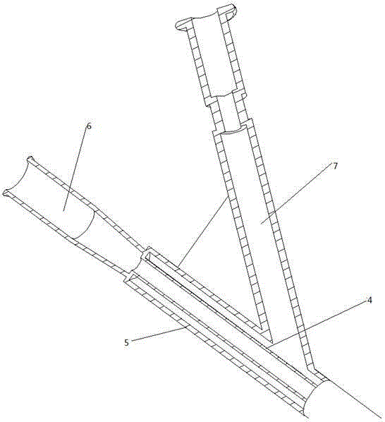 Balloon guide apparatus for pedicle approach kyphosis vertebroplasty operation