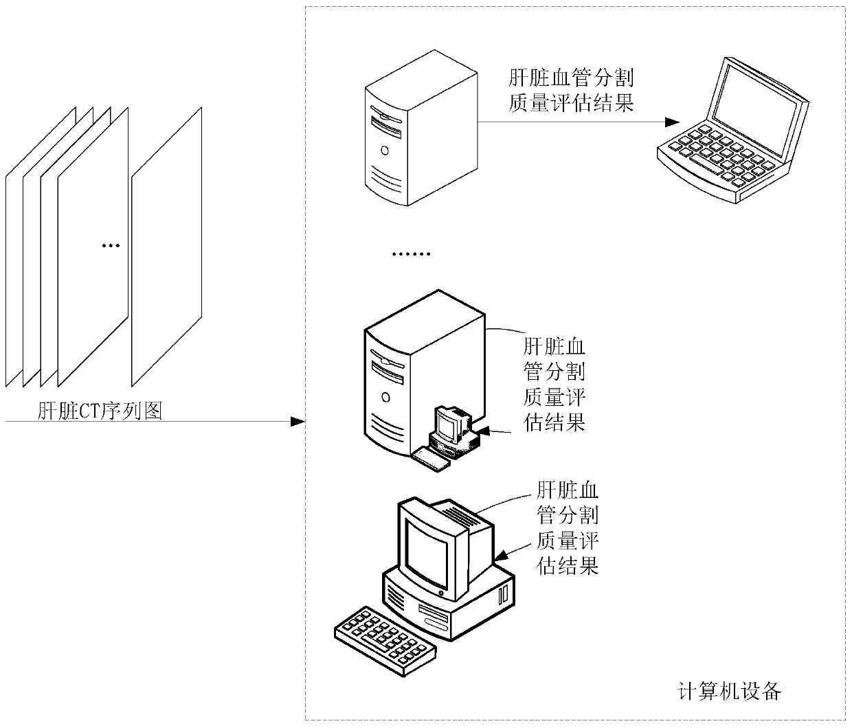 Liver image segmentation quality evaluation method and device and computer equipment